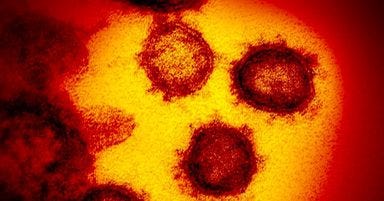 Photo au microscope du virus provoquant le Covid Photo au microscope du virus provoquant le Covid