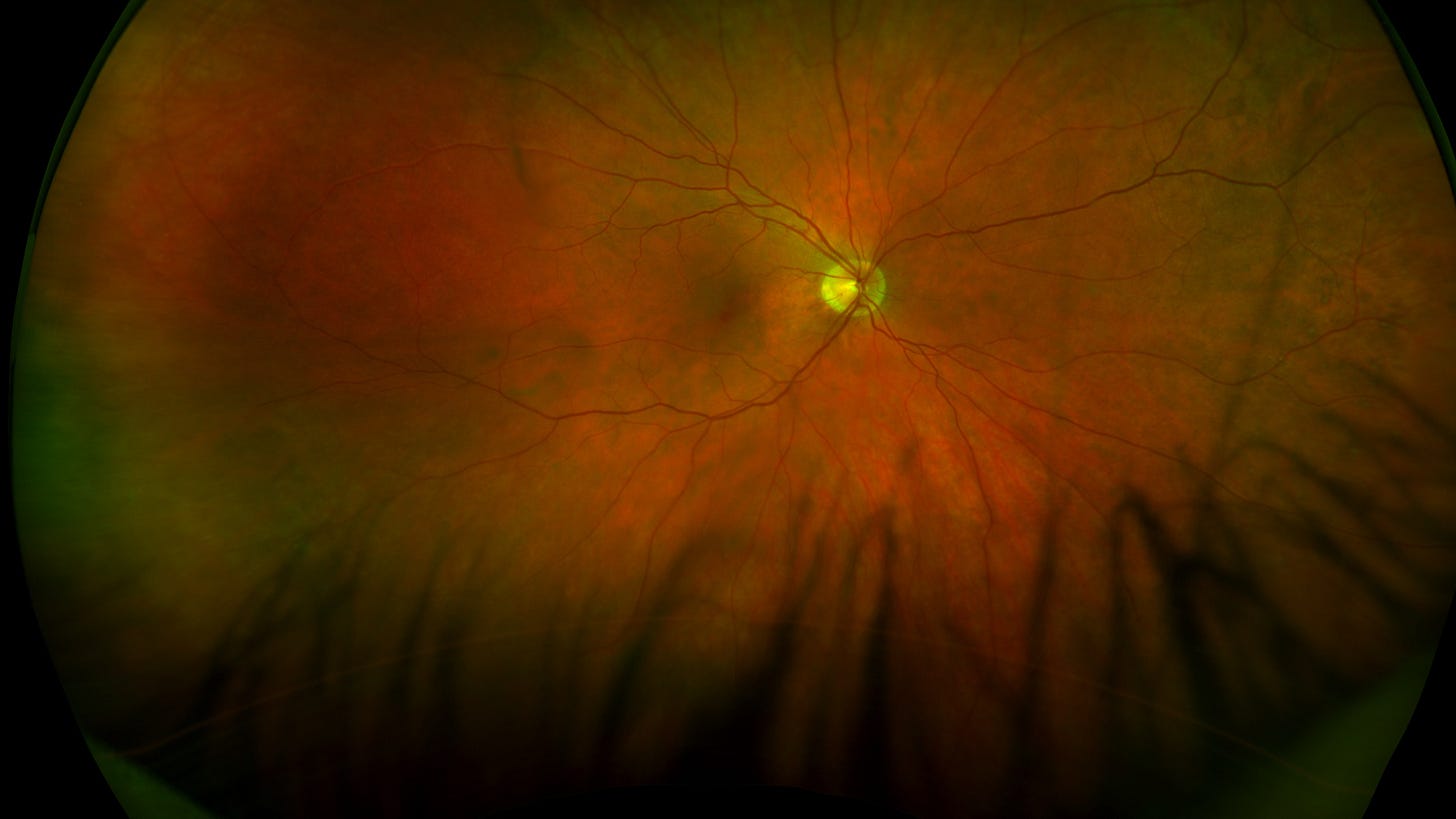 Detail from a retinal scan.