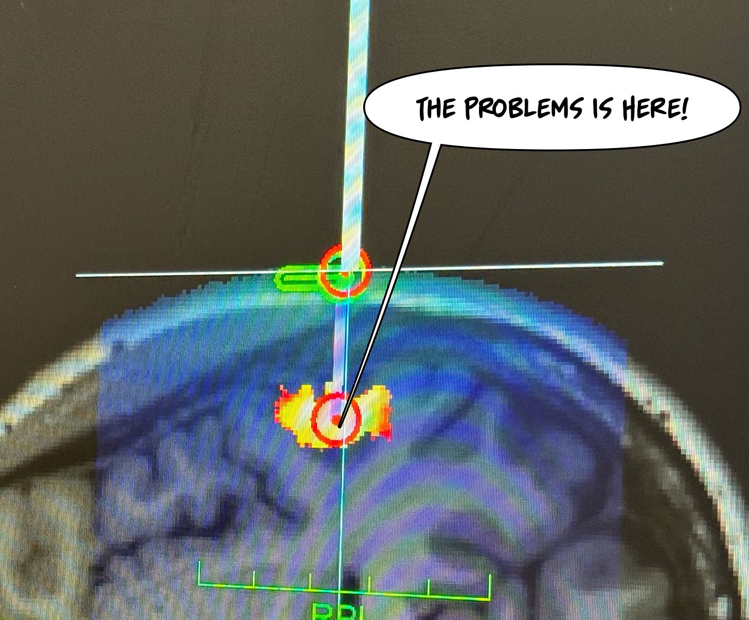 A brain scan with fmri guidance