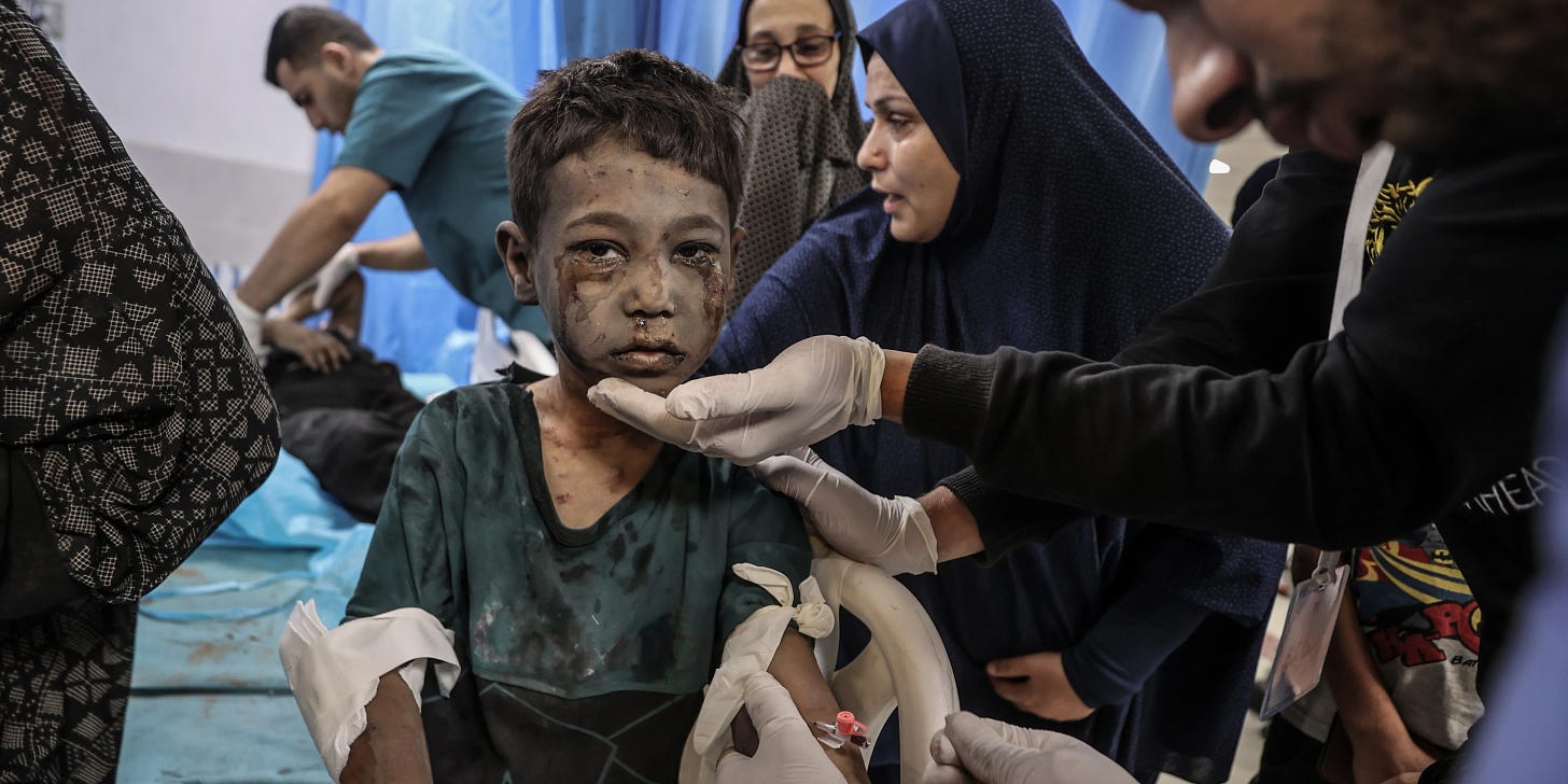 A photo of doctors examining an injured child at Al-Shifa Hospital. The child, who is smeared with dirt, dust, and dried blood, looks solemnly into the camera as they are being treated.