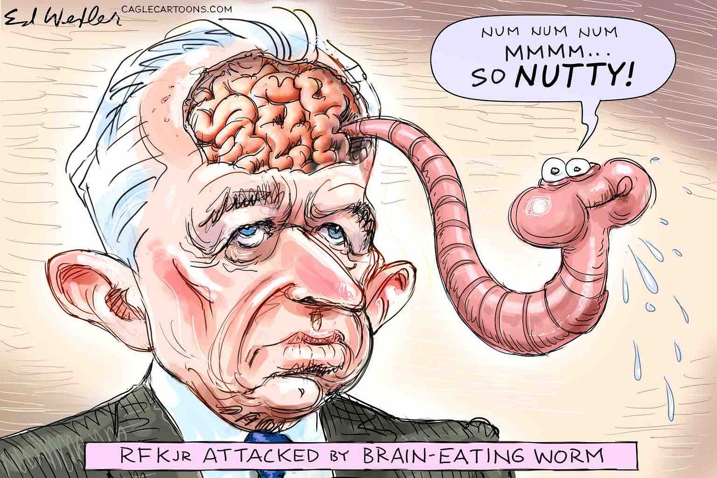 RFK Jr. says worm ate his brain