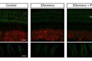 Prestin expression in OHCs from control, efavirenz, and efavirenz plus phytosterols-treated mice.