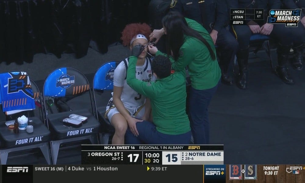 Hannah Hidalgo had to remove her nose stud mid-game vs. Oregon State