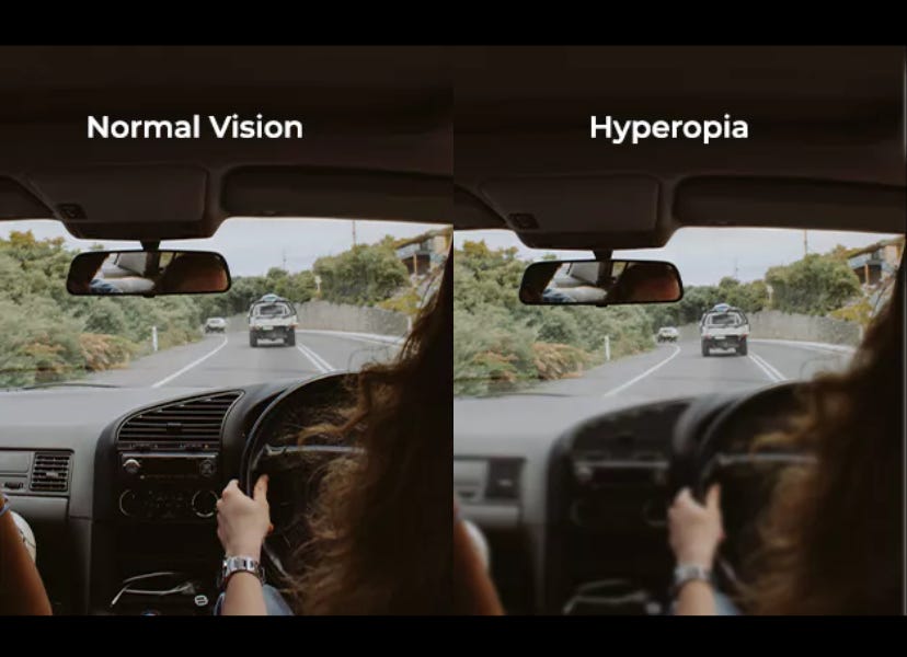 What is hyperopia | Vision Direct AU