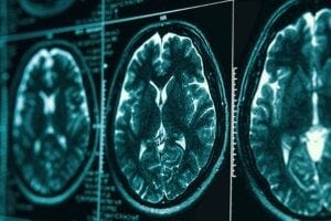 Films of a brain scan