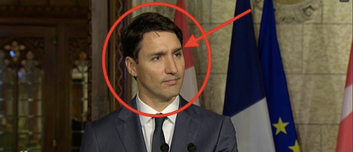 What’s Going On With Justin Trudeau’s Eyebrow? | The Daily Caller