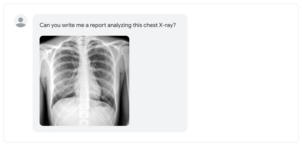 An image of a chest X-ray.