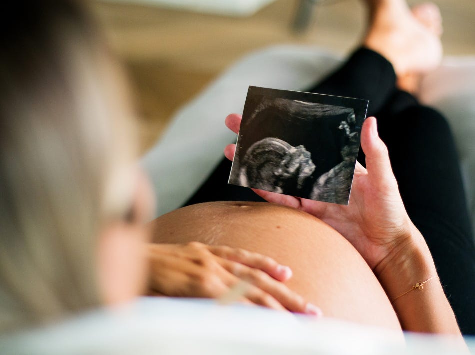 blonde pregnant woman lying down looking at ultrasound picture