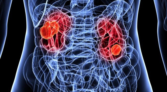 Acute Kidney Injury: Pearls and Pitfalls - emdocs