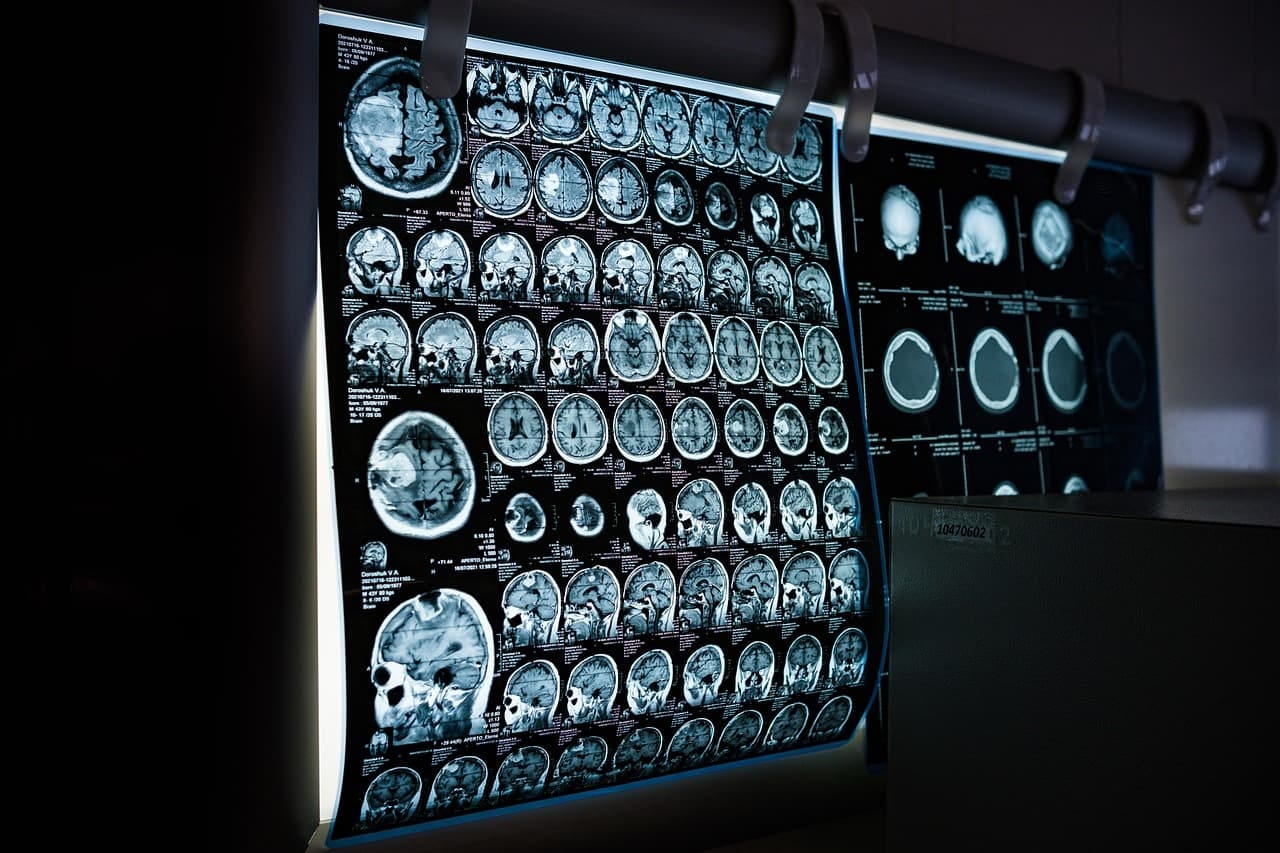 X-ray