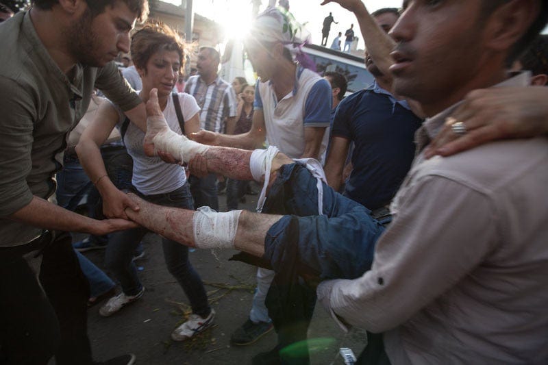 Two bombs went off in the crowd in Diyarbakir, Turkey, five people were killed and more than 400 injured were carried to ambulances. Violent attacks against Kurdish people are a motor behind displacement in the region. Under Informed Consent rules, the photographer would need to approach each of the people in the photograph to let them know how their images might be used. While it is feasible to do that, in this instance it would have had to be done in an ambulance, a Kurdish/English interpreter would be needed, and the unfolding of events around this scene would have been missed. Photo by Sean Hawkey. Two bombs went off in the crowd in Diyarbakir, Turkey, five people were killed and more than 400 injured were carried to ambulances. Violent attacks against Kurdish people are a motor behind displacement in the region. Under Informed Consent rules, the photographer would need to approach each of the people in the photograph to let them know how their images might be used. While it is feasible to do that, in this instance it would have had to be done in an ambulance, a Kurdish/English interpreter would be needed, and the unfolding of events around this scene would have been missed. Photo by Sean Hawkey.