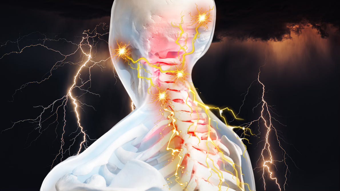 In the dark, a lightning storm crackles. The outline of a human skeleton shows glowing red between the neck vertebrae, up into the base of the skull. Angry orangish-gold sparks flare, sending more lighting jolts from the lower left neck to the upper right neck to the left jaw and the right occipital bone in a zig-zagging pattern of pain and short-circuiting.