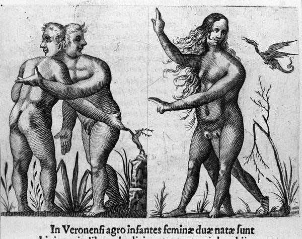 Different types of human monsters: a man with double bodies and heads and a woman with four legs and two sexes. Engraving from “De monstrorum natura, causis et differentiis” by Fortunio Liceti (1577-1656), Italian scientist. 1646 by Italian School