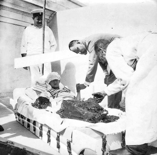 r/HistoryPorn - Tsarevich Alexei Nikolaevich of Russia during a mudbath treatment (probably a naturopathic attempt to treat his hemophilia) at Livadia, Crimea, Autumn 1913. In the background stands Alexei's sailor nanny Andrei Derevenko, Dr. Botkin holds the left hand of the Tsarevich. [1024x1010]