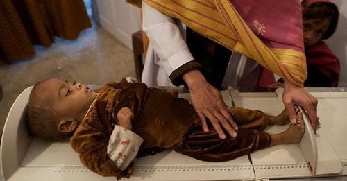 One in five children in Pakistan is suffering from wasting, says UNOCHA report : Peoples Dispatch