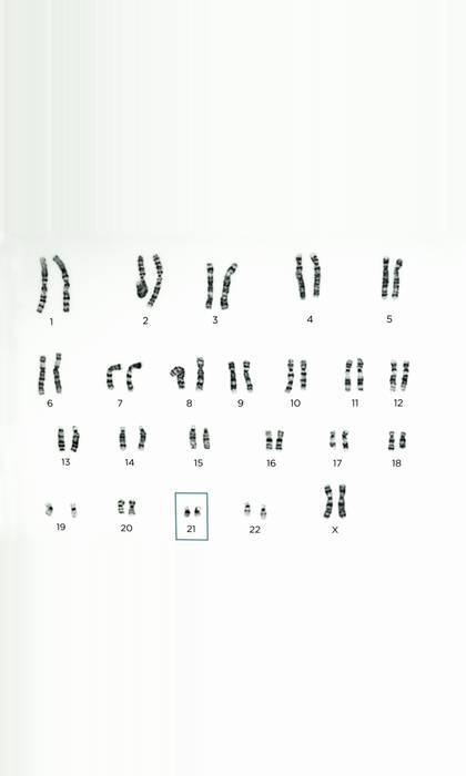 Scientists believe that the Y chromosome has degraded over time. Credit: Peter Blixt / Alamy Stock Photo