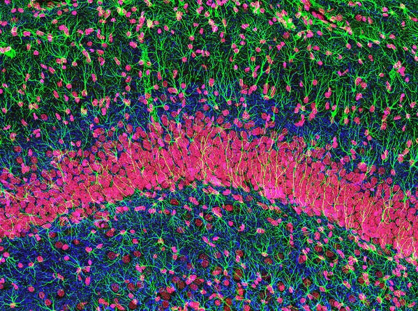 Hippocampus Poster featuring the photograph Hippocampus Brain Tissue by Thomas Deerinck, Ncmir