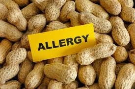 What Are Peanut Allergy Symptoms ...