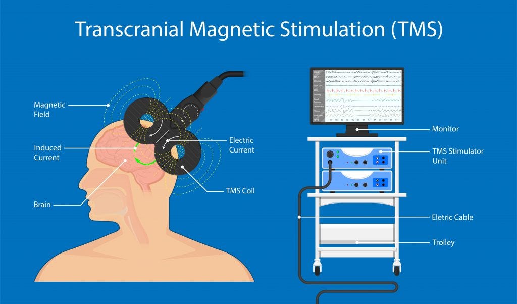 Stylized drawing showing a Transcranial Magnetic Stimulation set-up. On the left is a genderless person receiving TMS. A magnetic field, induced current, brain, electric current, and TMS coil are labeled. On the right is a trolley holding the TMS Stimulator Unit and an electric cable, which are labeled.