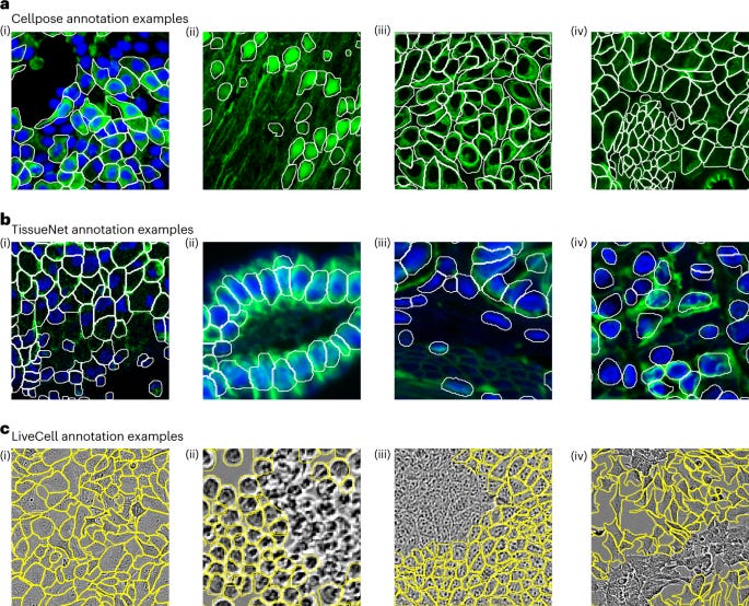 Cellpose 2.0: how to train your own model | Nature Methods