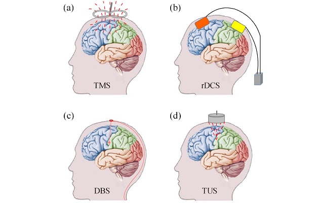 Figure 1. Demonstration of typical neuromodulation techniques: (a) transcranial magnetic stimulation (TMS), (b) transcranial direct current stimulation (tDCS), (c) Deep brain stimulation (DBS), and (d) transcranial ultrasound stimulation.