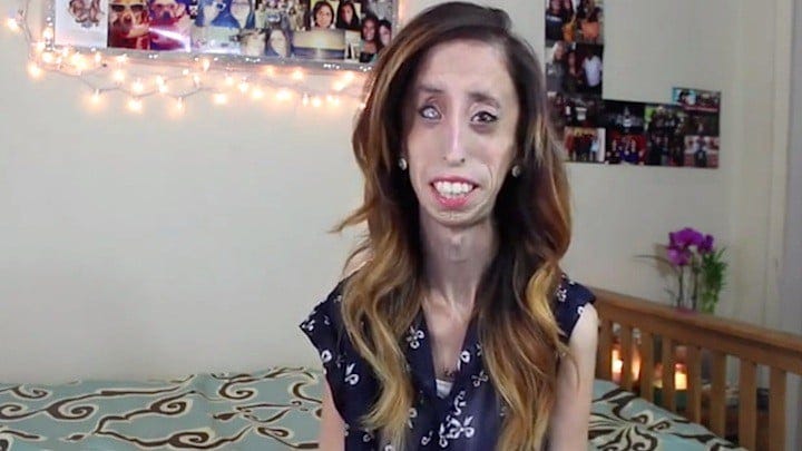 Lizzie Velasquez for The Lizzie Project