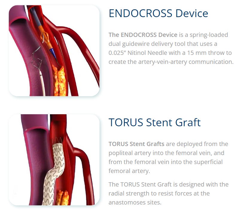 DETOUR system: Endologix