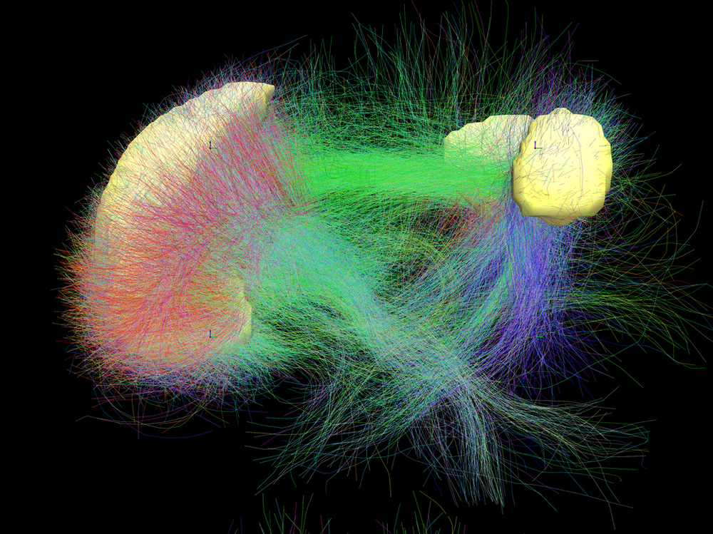 Color graphic of the default mode network of the human brain