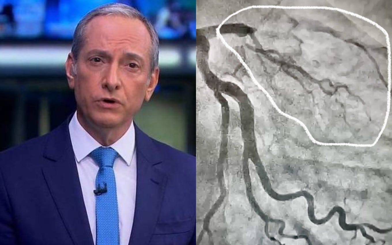 After a heart attack, José Roberto Burnier exposes the exam and reveals what saved his life · TV News