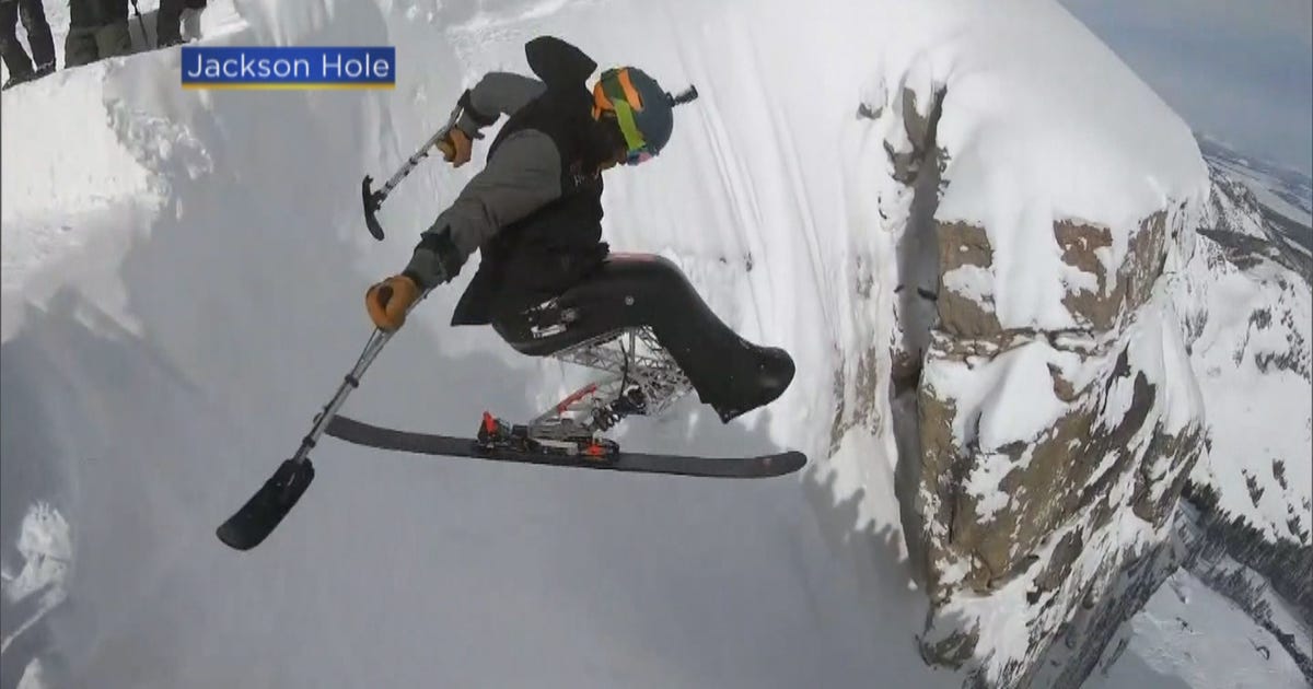 Back-Breaking Crash Not Slowing Colorado Skier With Thirst For More - CBS  Colorado