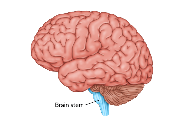 Brain Stem Stroke: How It Affects the Body & What to Expect