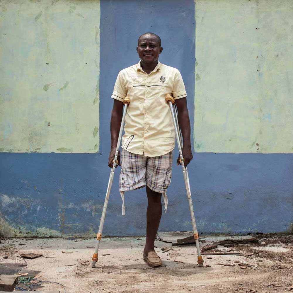 biafra protestor lost leg new violence