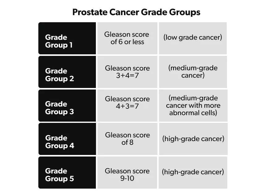 Prostate Cancer: Stages, Grades, and Treatment | Ro Man