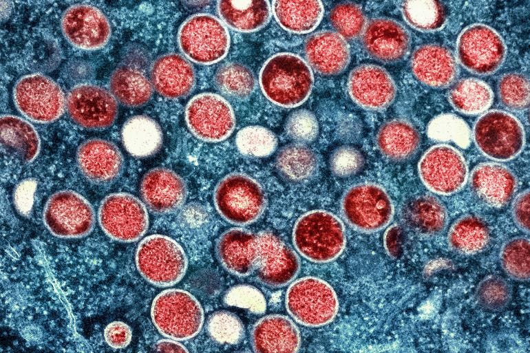 mpox under microscope mpox under microscope
