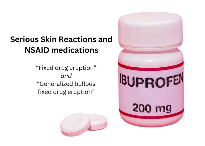 Fixed Drug Eruptions and NSAIDs - FDA warning