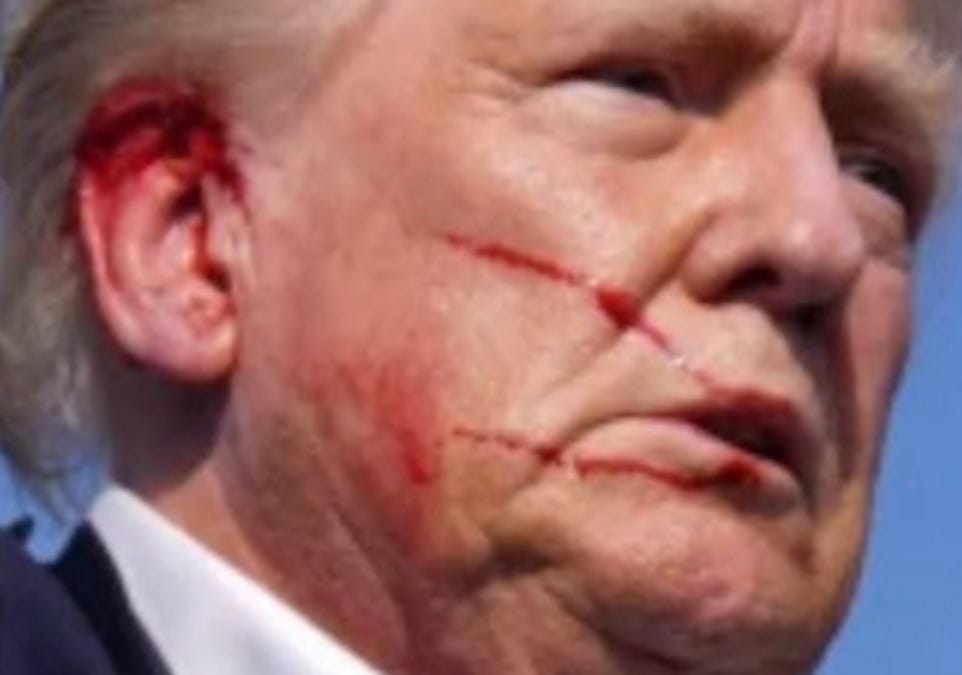 zoomed in pic of trump's wounds