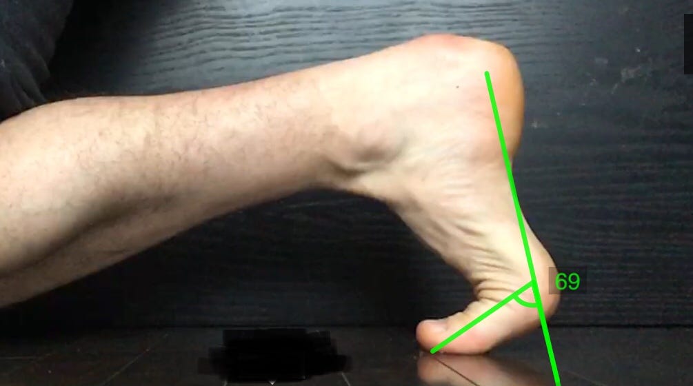 Why Is The Big Toe So Important For Runners? | Matthew Boyd Physio