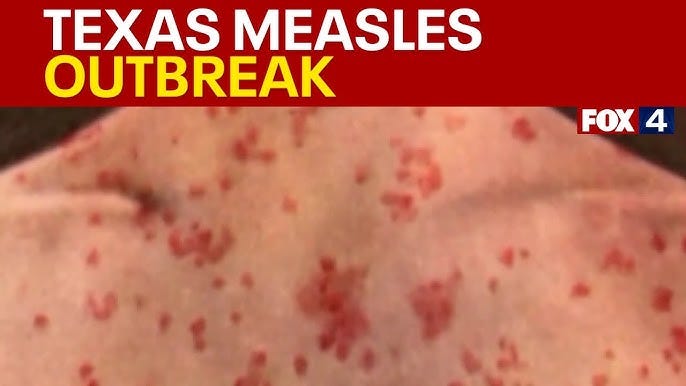 Texas Measles outbreak 2025: 124 cases identified - YouTube