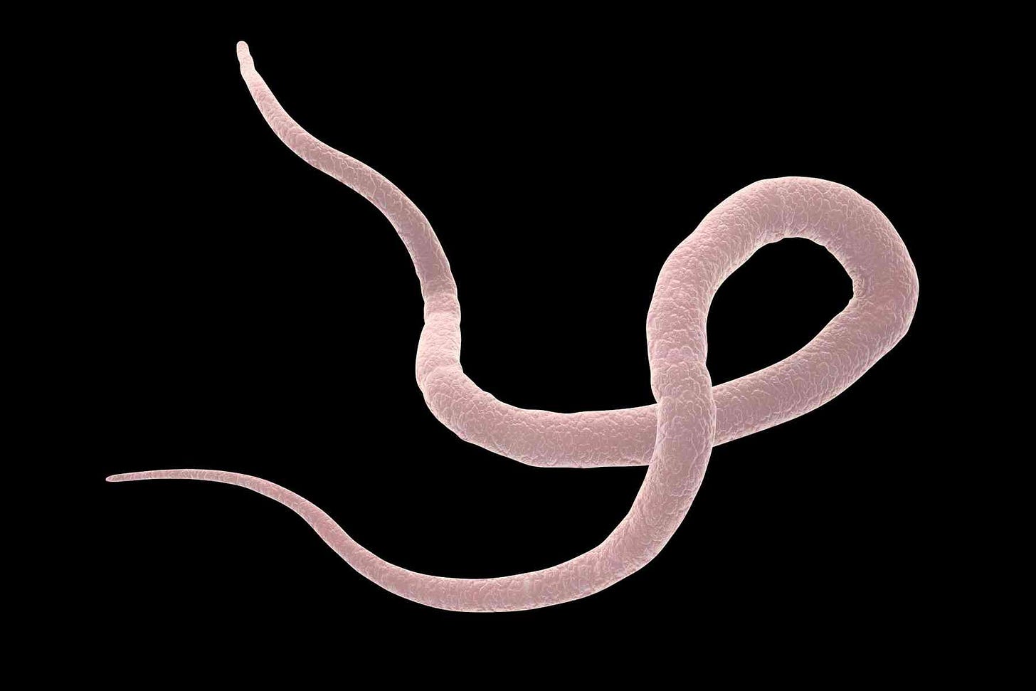 How parasitic worms could lead to new treatments for asthma | LaptrinhX ...