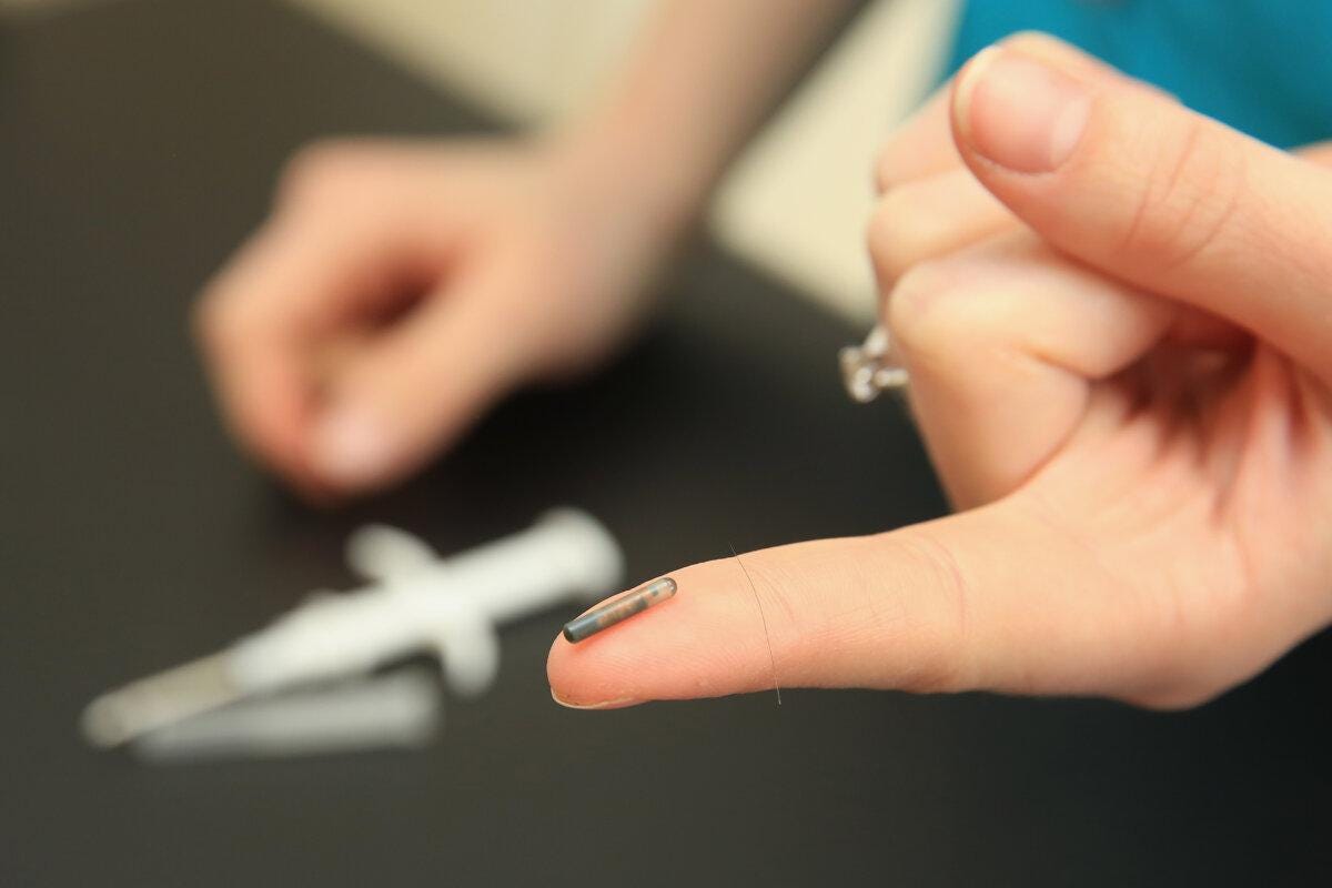 A veterinary nurse holds a dog microchip at the PDSA pet hospital in Wolverhampton, England, on April 4, 2016. (Christopher Furlong/Getty Images)