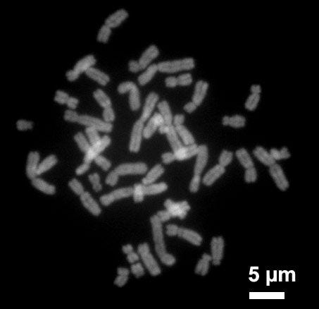 humanchromosomeschromomycina3