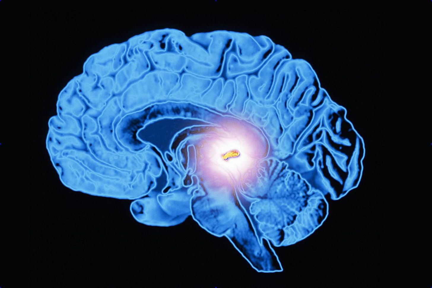 The Function and Location of the Pineal Gland