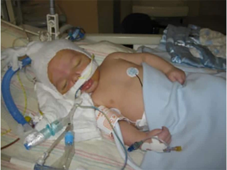Baby Judah hooked up to machines in the ICU