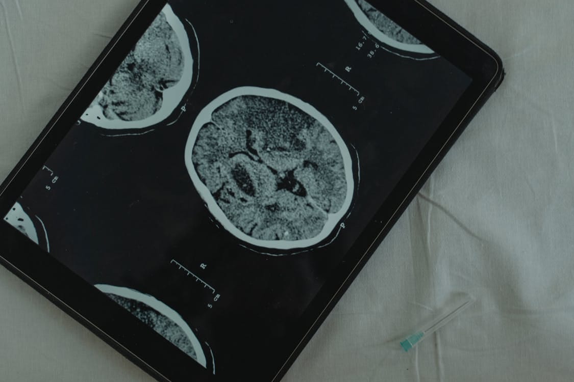 Free Close-up view of a brain CT scan displayed on a digital tablet with a medical needle beside it. Stock Photo