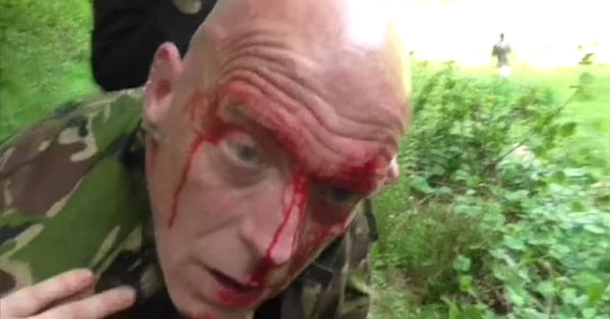 Hunt saboteur's face covered in blood after an attack by followers of the Cheldon Buckhounds