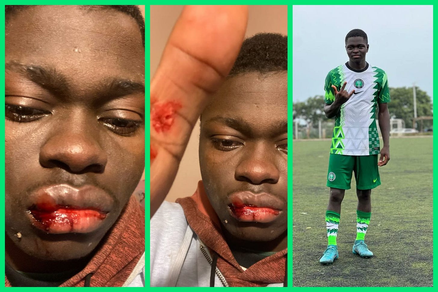 Like Didier Drogba warned, Nigerian starlet Moses Jerry beaten by fake  Serbian football agent — The Full story - Soccernet NG