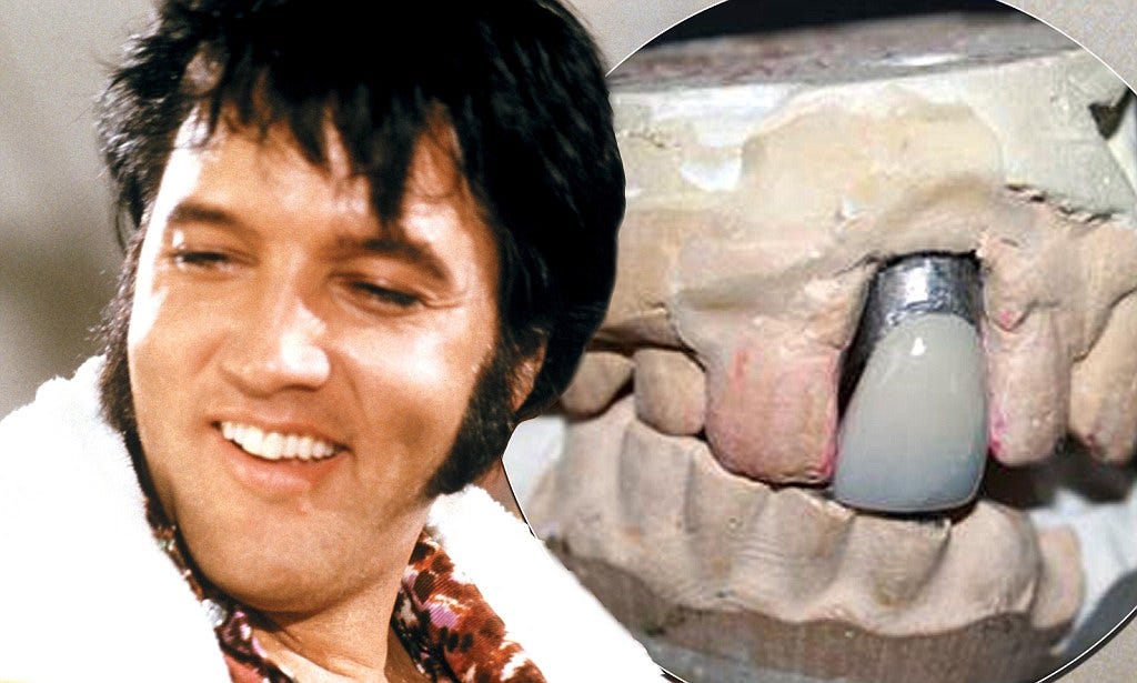Elvis Presley dental mould expected to fetch £10k at auction | Daily Mail  Online