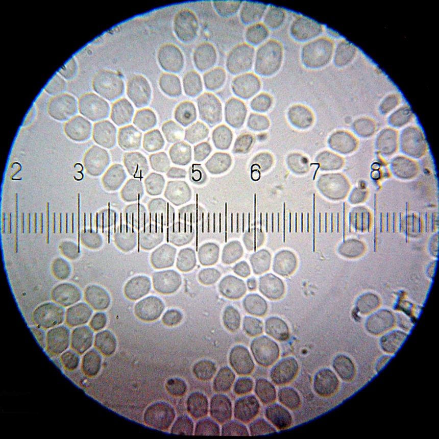 20100911 162900 saccharomycescerevisiae