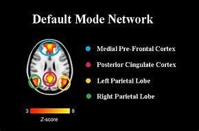 Image result for DEFAULT MODE NETWORK