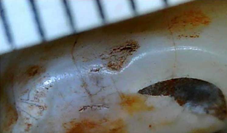 A close-up photo of a Homo naledi tooth with a large chip on the edge